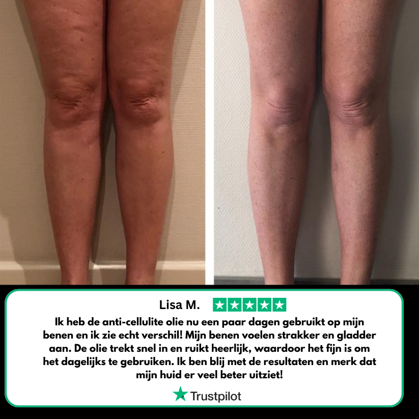 Aceite anti-celulitis