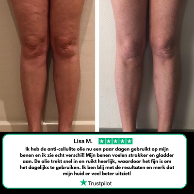 Aceite anti-celulitis